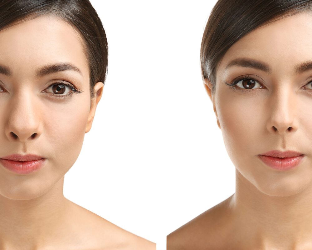 Young woman before and after rhinoplasty on white background. Pl Young woman before and after rhinoplasty on white background. Plastic surgery concept