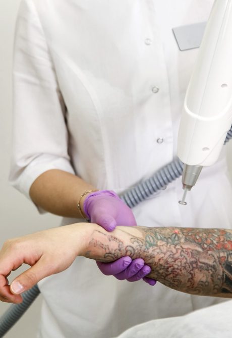 Cosmetologist with patient and professional tattoo removal laser from hand in salon Cosmetologist with patient and professional tattoo removal laser from hand in salon