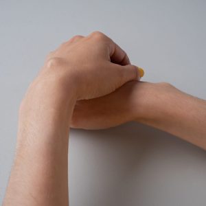 Ganglion cyst on woman hand on white background